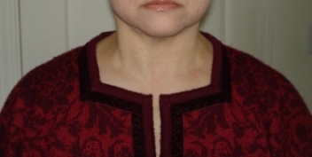 squarenecklineexample